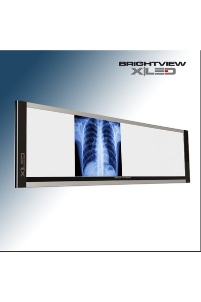 Edesign BRIGHTVIEW İNCE DÖRTLÜ NEGATOSKOP - XRAY FILM VIEWER