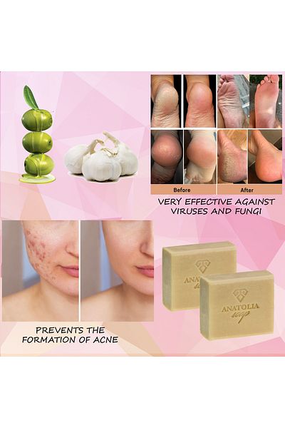 Anatolia Soap Garlic Soap Hair Care