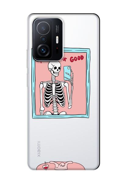 frondcase حافظة هاتف شفافة لهاتف Xiaomi Mi 11t Pro You Look Good Skeleton