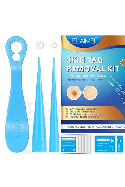 CeymSTecH cilt etiketi yakı kaldırma kiti düzenli yakı halka aparatı(1mm-9mm)