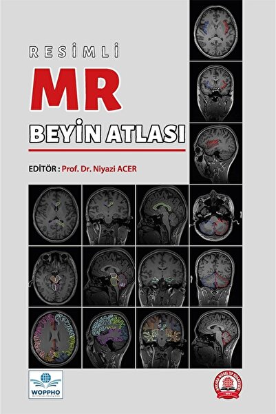 Ankara Nobel Tıp Kitabevi Resimli MR Beyin Atlası