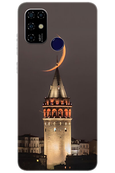 CASPER Via F20 Uyumlu Kılıf Desen Baskılı Silikon Galata Kulesi STK:673 CP-ta...