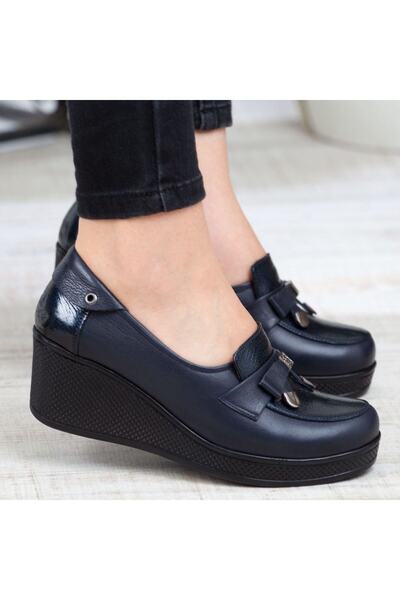 IVEKO Жіночі чорно-сині ортопедичні туфлі з натуральної шкіри (беріть на розмір більше)