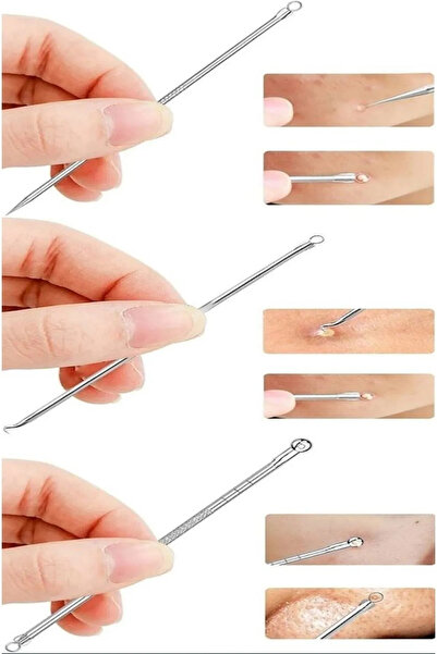 Genel Markalar Akne Siyah Nokta Temizleyici 4'lü Set Paslanmaz Çelik Komedon ...