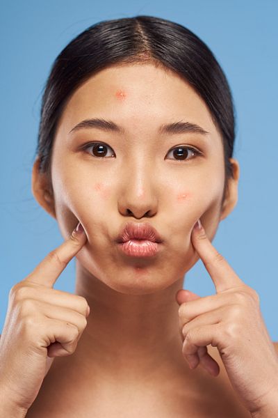 PRO PURE SKIN CARE 10% Glycolic Acid Renewing Face Serum