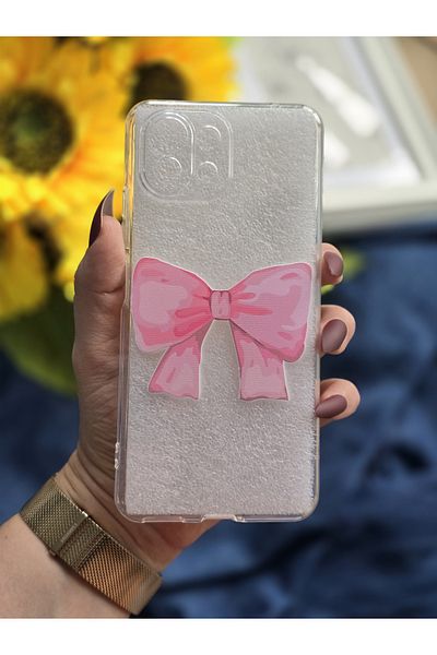 SUPER FRAME حافظة هاتف شفافة مطبوعة متوافقة مع هاتف Xiaomi Mi 11 Lite