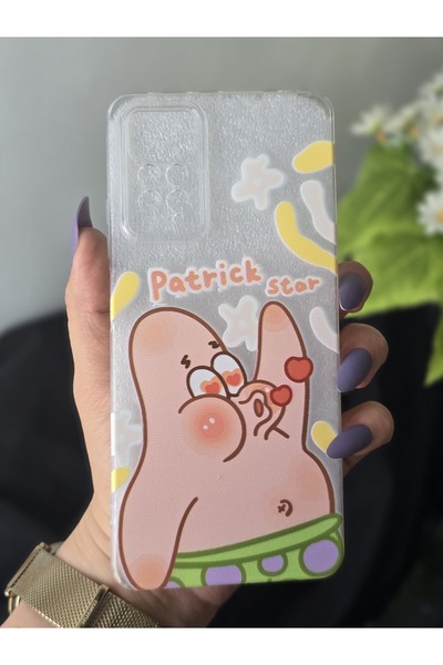 SUPER FRAME Xiaomi Redmi Note 11 Pro & Note 12 Pro 4G Uyumlu Baskılı Şeffaf T...