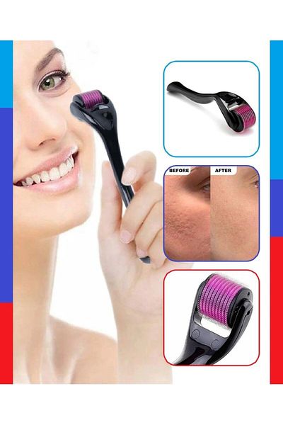 CARNIVAL LAND Hair Removal Comb - Titanium Needle Derma Roller Skin Renewal 0.5 Mm
