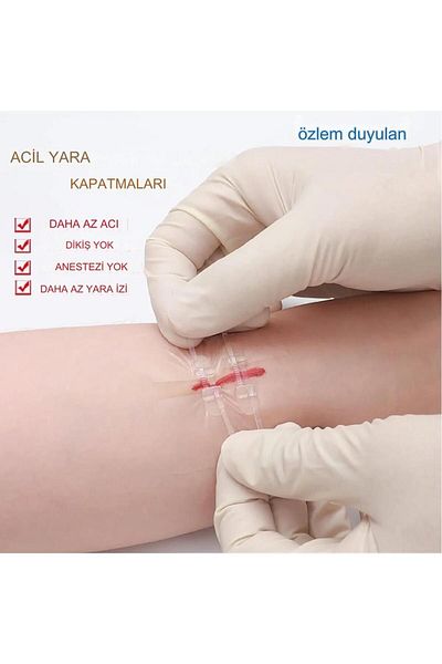 Longmed إغلاق الجروح في حالات الطوارئ، أشرطة بسحاب، خياطة غير مؤلمة، ضمادات لإصلاح المسيل للدموع والإسعافات الأولية