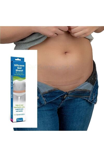 RE-GENERATION Silikon Sheet - Silikon Jel Tabaka -doğum Sonrası Izleri Giderir - Ameliyat Izleri 15x4,0x0,1 Cm