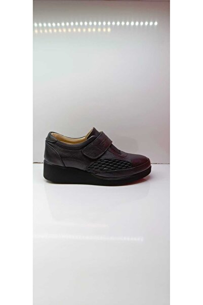 Missmamma Hakiki Deri Kemik Deformasyonuna Özel Aayakkabı