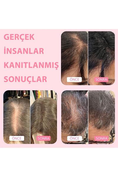 Boldify Saç Dolgunlaştırıcı Fiber, Topik Tozu Koyu Kahve 28gr- Hair Building Fibers