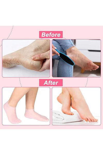 SAVORYHOME Silicone Foot Care Socks - Moisturizing, Gel Socks, Anti-Crack, Dead Skin Shooter Socks053