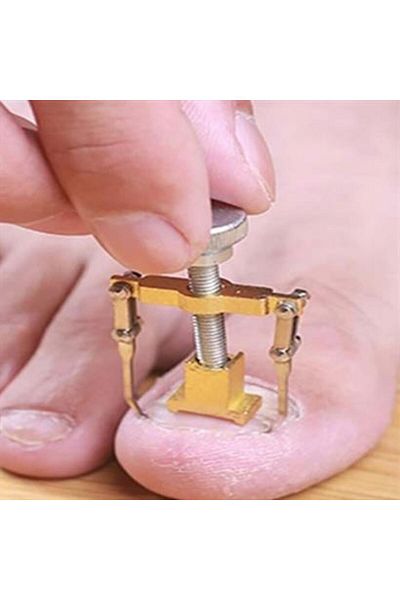 Toptan Bulurum Shopzum Sinking Nail Correction Tool Ingrown Nail Remover Apparatus