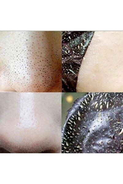 ABETE Güney Koreden Ithal Siyah Nokta Burun Bandı