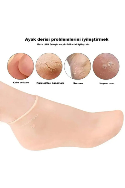 RED KİTCHEN Silikon Ayak Bakım Çorabı Nemlendirici Jel Çorap Çatlak Önleyici ...