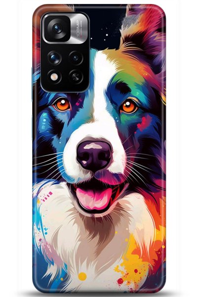 adveksiyon Xiaomi Redmi Note 11 Pro Plus 5g Case Hd Printed Case - Followed I...