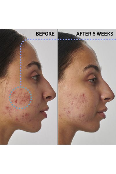 THE INKEY LIST SuperSolutions 1% Retinol Serum - 30 Ml