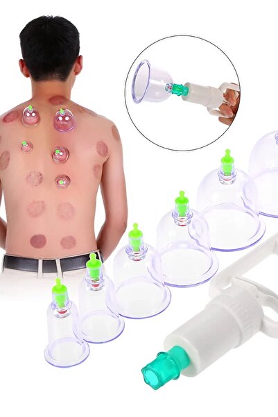 Genel Markalar Vakumlu Bardak Kupa Çekme Seti Hacemat 12 li