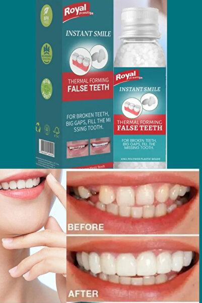 Uniquem Diş Yapma Seti Eksik Diş Giderme Yama Yapma Seti Protez Takma Boncuk Diş