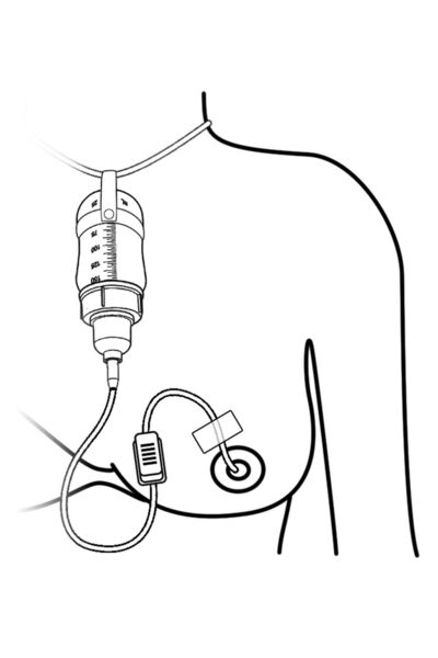 Eday Emzirme Destek Sistemi Eds 150ml -ayd150