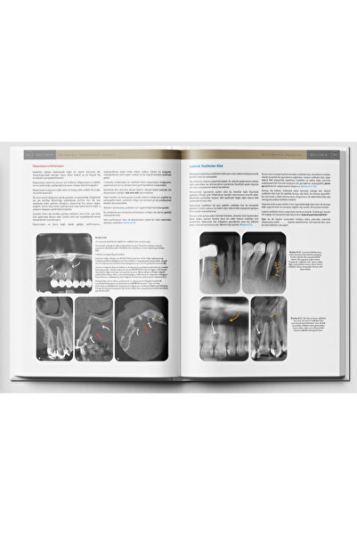 campusdent Endodontik Radyoloji