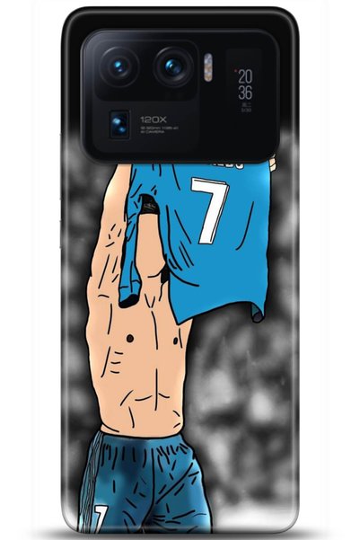 adveksiyon Xiaomi Mi 11 Ultra Case Hd Printed Case - Followed Institution 5100