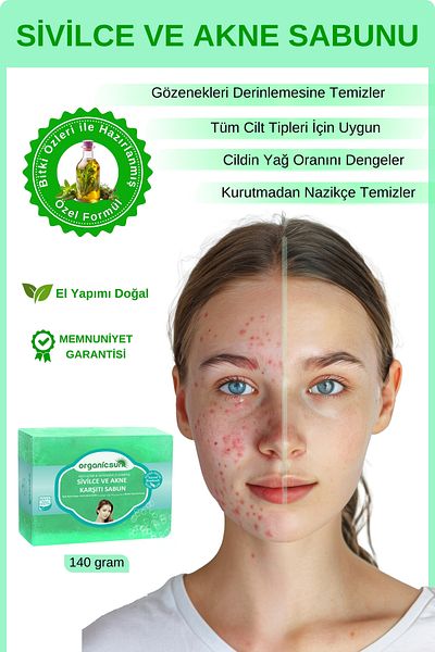 Organicsun صابون طبيعي 140 جرام - مضاد لحب الشباب والبثور، لجميع أنواع البشرة