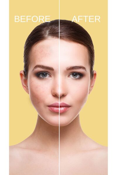 cremika Kozmetik Botox Effect Extension Set of 4, Nourishing, Purifying, Whitening Complete Care.