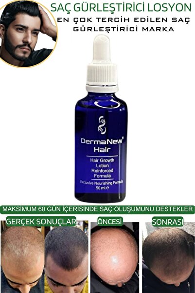 dermanew hair Dermanew Saç Losyonu Saç Bakım Yağı - Saç Gürleştirici - Sac Serumu losyon 5 Adet Roller