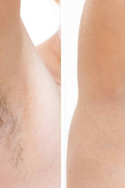 Galancy Silver Yüz Bikini Bölgesi Soyulabilir Granül Boncuk Ağda 2 X200gr