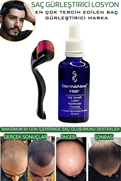 dermanew hair Dermanew Saç Losyonu Saç Bakım Yağı - Saç Gürleştirici - Sac Serumu losyon 5 Adet Roller
