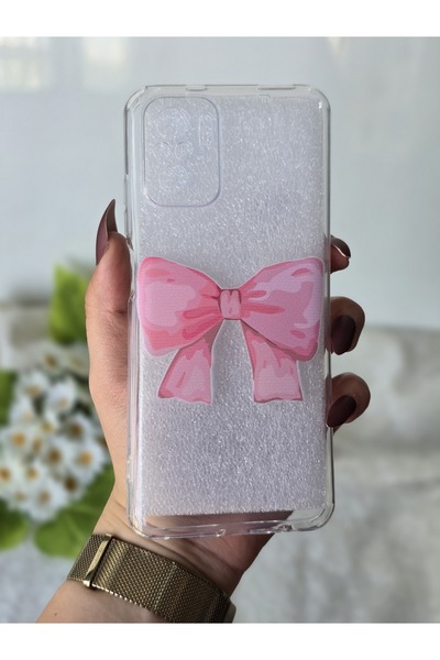 SUPER FRAME حافظة هاتف شفافة مطبوعة متوافقة مع هاتف Xiaomi Redmi Note 10 / 10s