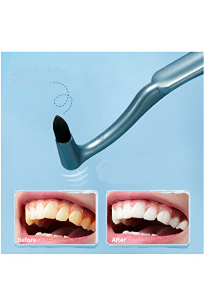 5D WHITE Diş lekesi temizleme fırçası, ve diş taşını giderirci taşınabilir di...