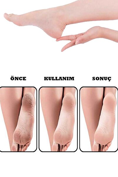 ruby face Rubyface Çift Taraflı Mavi Topuk Rendesi