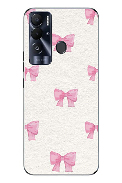 TECNO Pova Neo Kamera Korumalı Baskılı Desenli Özel Seri kılıf Kapak