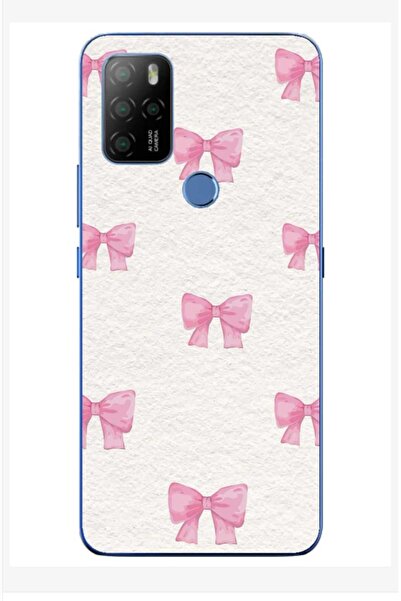 omix X300 Kamera Korumalı Baskılı Desenli Kurdaleler stkx34