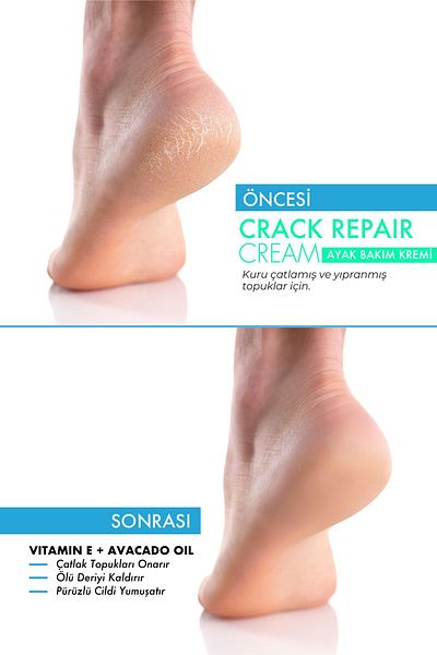 Picco De Luce MRS.UMRANTOO 100 ml Foot Care Cream - Crack Repair Cream