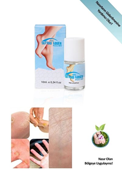 Tattoo Loser Nasır Sökücü Ve Topuk Çatlağı Giderici