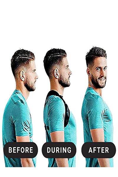 Ankaflex Αθλητικός κορσές στήριξης σταθερής στάσης κατά της καμπούρασης Νέας γενιάς