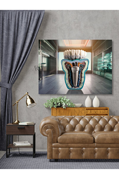 AR AJANS KANVAS TABLO Implant dentar bioluminiscent Dentist Ortodontie Pânză ...