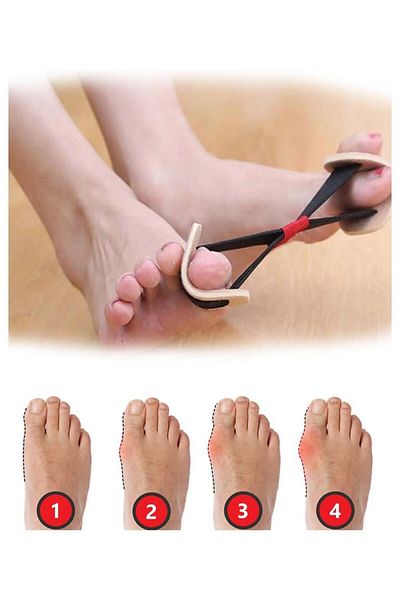 CMT Exercise Toe Rubber