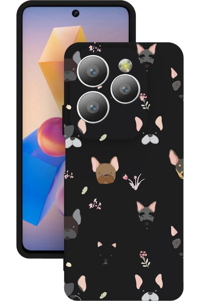 omix X7 Baskılı ve Kamera Korumalı Siyah Renk Silikon Kılıf