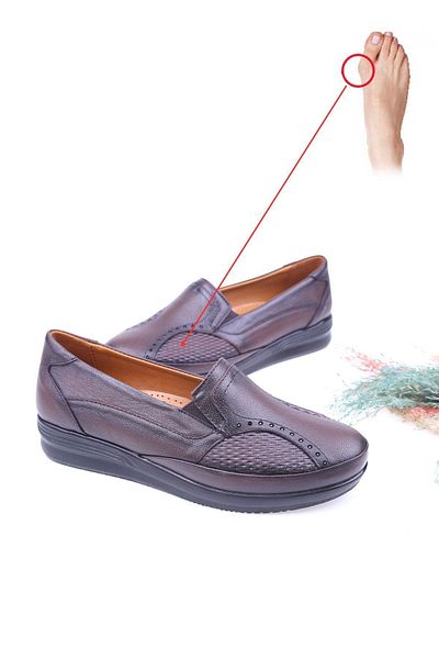 Papuçsepeti Papuç Sepeti 2505 Women's Genuine Leather Orthopedic Shoes