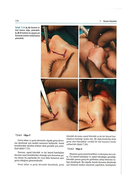 Avrupa Tıp Kitabevi Rinoplasti Atlası