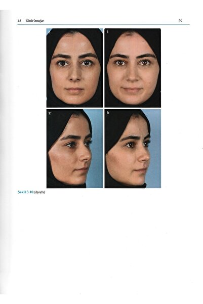 Avrupa Tıp Kitabevi Rinoplasti Atlası