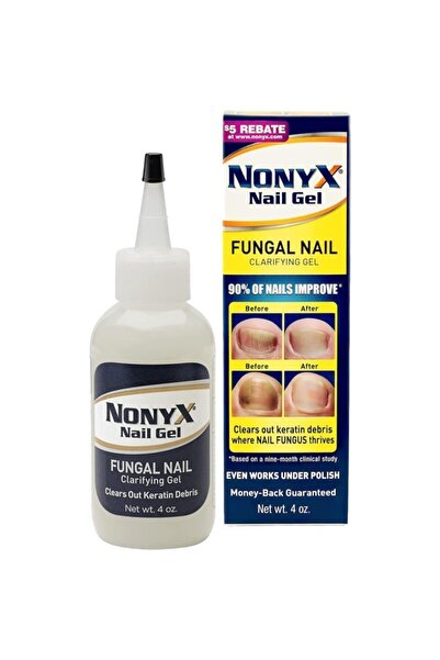 Nonyx Nail Gel 113gr