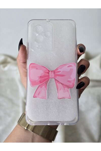 SUPER FRAME حافظة هاتف شفافة مطبوعة متوافقة مع General Mobile GM 24 PRO