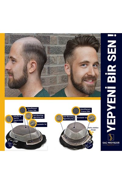 SACPROTEZİM Black 6X8 Prosthetic Hair Ancora - 1B Model with Fine Strands and All Directional Bottom Build 100% Human Hair