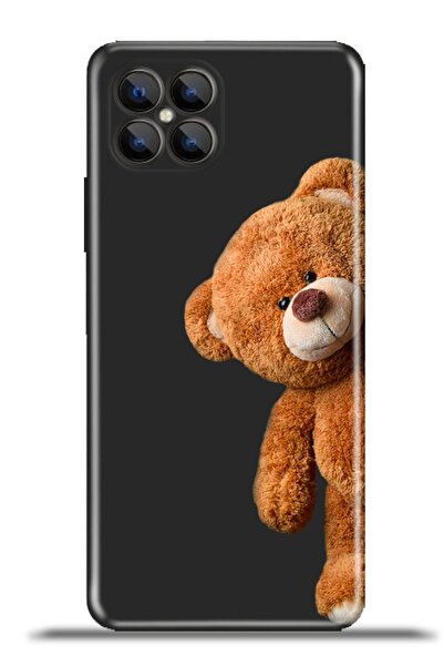 omix X600 Kılıf Esnek Silikon Kapak Kamera Koruma Özel Tasarım - Meraklıted